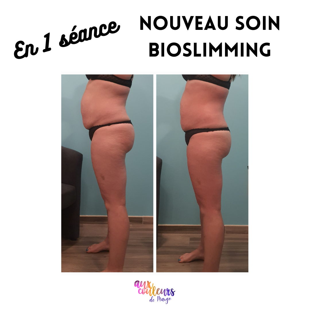 Soin Minceur Bioslimming 2 zones image